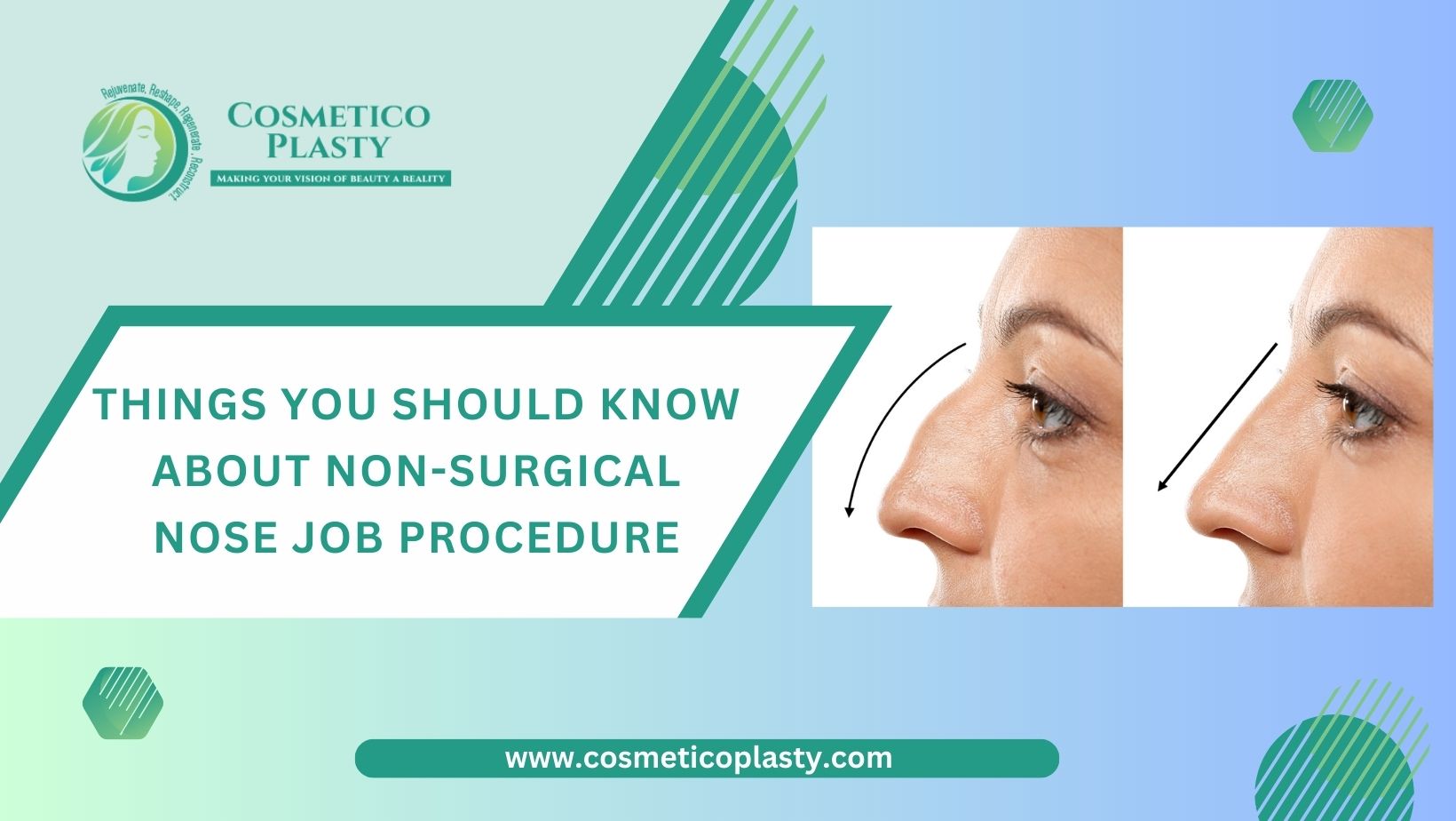 Things you should know about non-surgical nose job procedure