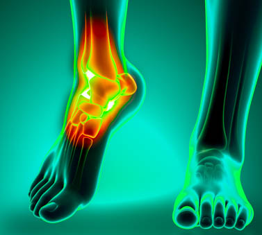 Acupuncture for Ankle Pain