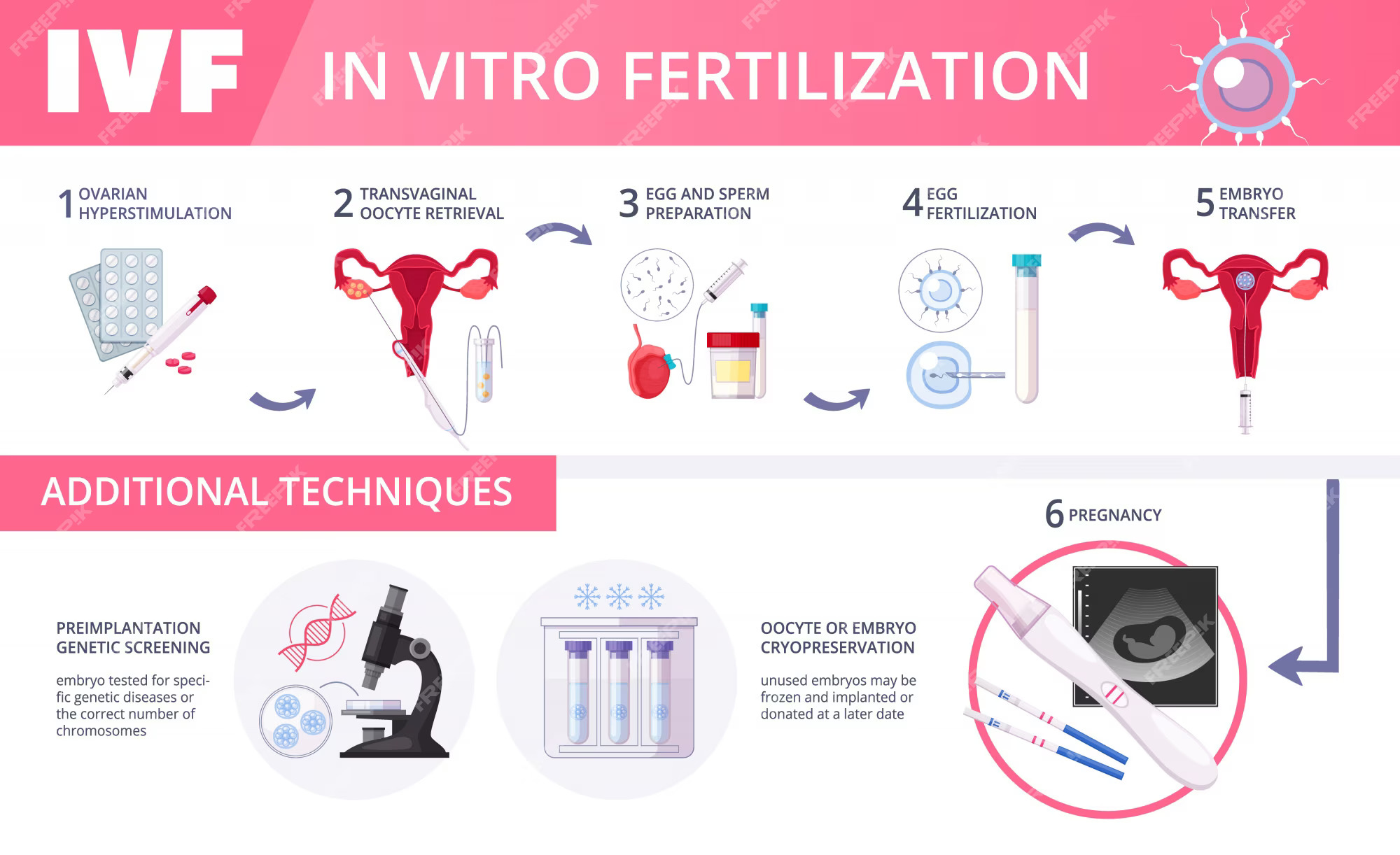 What Are The Different IVF Protocols