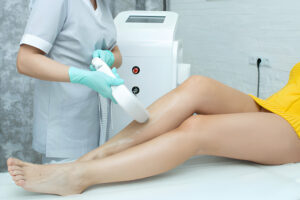 Benefits of IPL Hair Removal