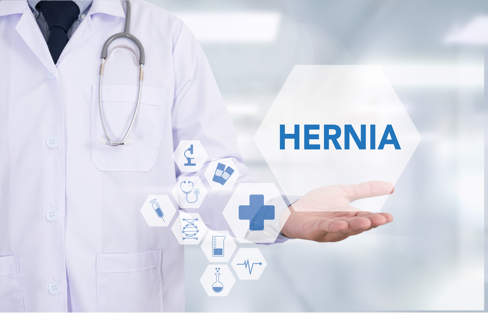 What Is a Hernia and How Does It Develop?