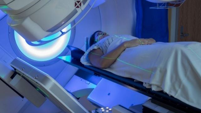 Radiation Therapy side effects