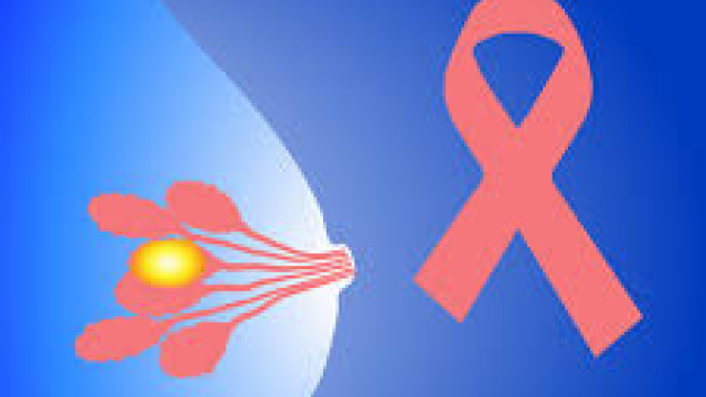 What are Breast Cancer Treatment?