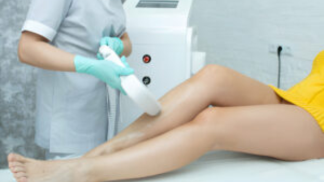Why Should You Consider Laser Hair Removal?