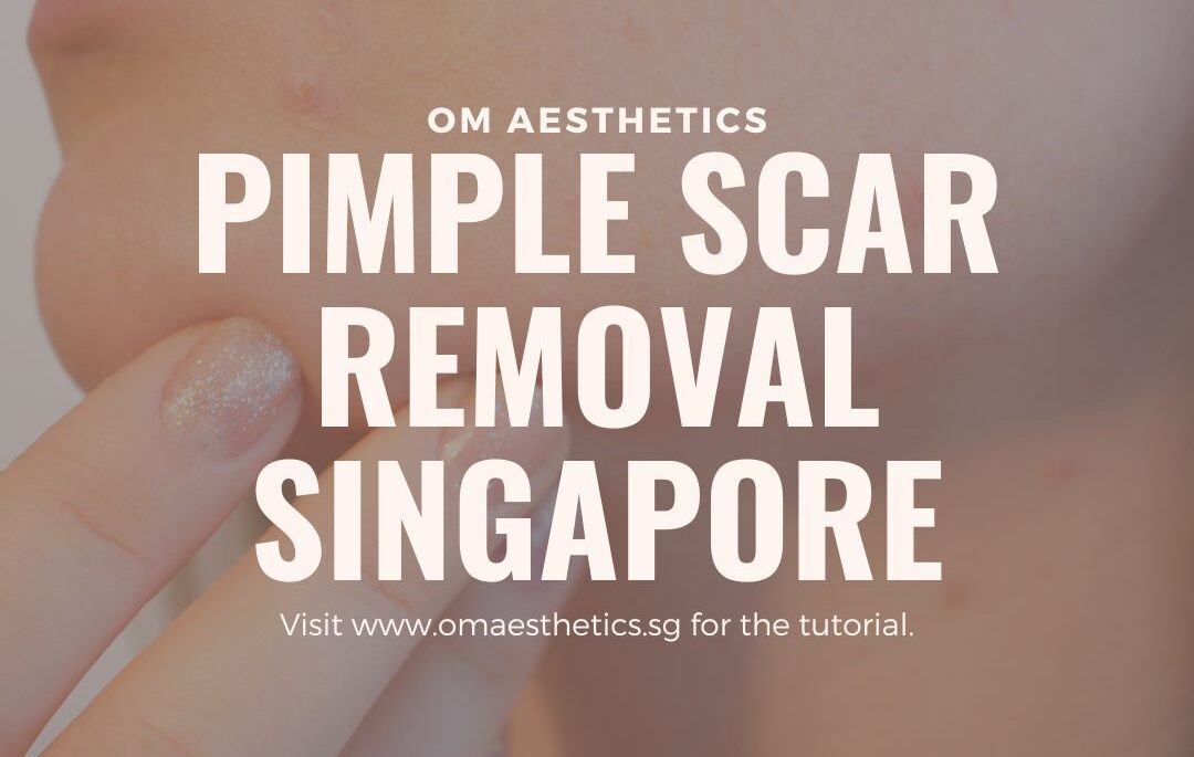 pimple scar removal