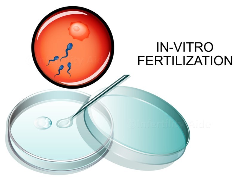 Fertility Center